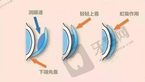 苏州光明眼科医院收费价格:合理且有优惠