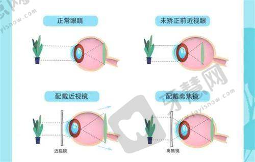 就诊注意事项