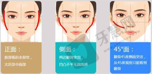 翘睫是什么样的价格和修复期?—— 厦门海峡全新报价 + 术后护理指南