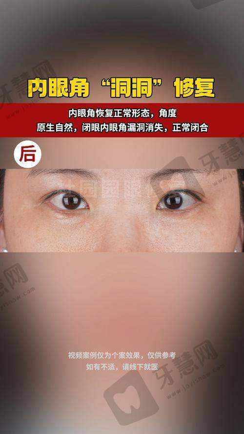 沈阳曙光整形医院院长叫什么?车金昊院长隆胸技术深度解析:为啥“2万起”还能火出圈?