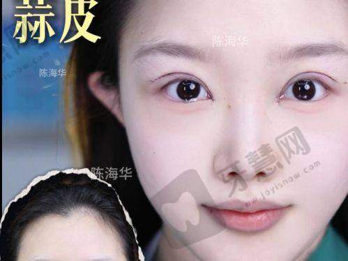 沈阳曙光整形医院怎么样?术后护理与避坑指南