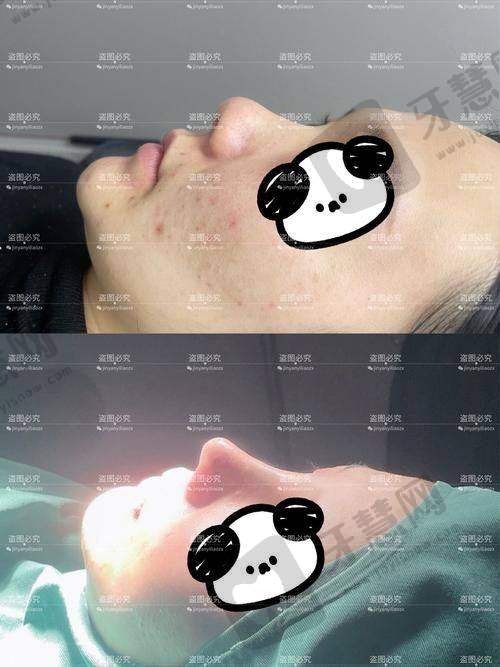 辽宁曙光整形医院和百嘉丽哪个好?真实口碑对比:抗衰老客户认准曙光,年轻求美者偏爱百嘉丽
