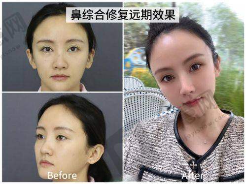 五、沈阳曙光整形医院地址背后的实力:为啥这么多姐妹跨区也要来?