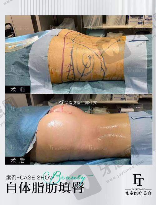 辽宁曙光整形外科医院怎么样啊?价格是否合理?真实收费表来了!