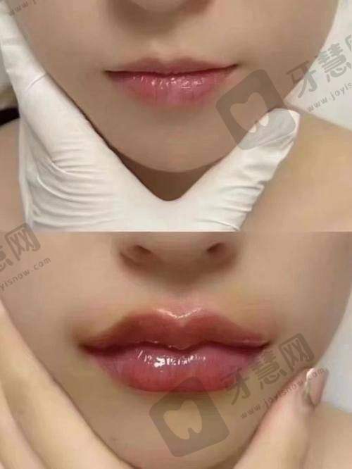 理性提醒:医美没有“万能方案”,正规医院+适合自己才是更好