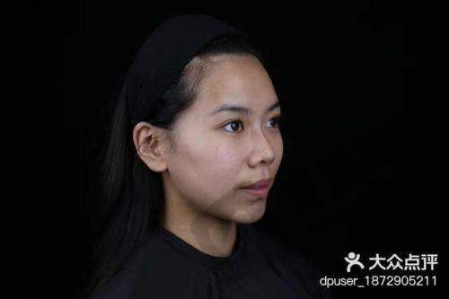 沈阳杏林美容整形医院怎么样【2025口碑揭秘】四级资质靠谱吗？医生技术强|价格透明|正颌拉皮口碑好！