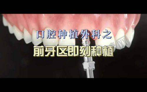 沈阳米兰口腔怎么样?总结与建议