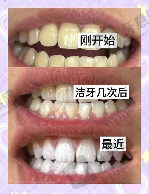 沈阳全好口腔总部患者真实评价