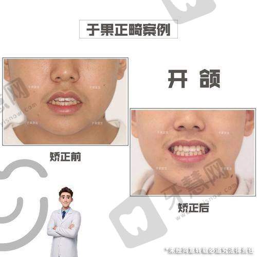 沈阳欢乐口腔医院是国有的吗?2025全新价格表曝光