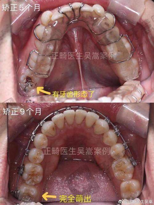 沈阳全好口腔电话号码多少?医生团队大揭秘,找对医生少走弯路!