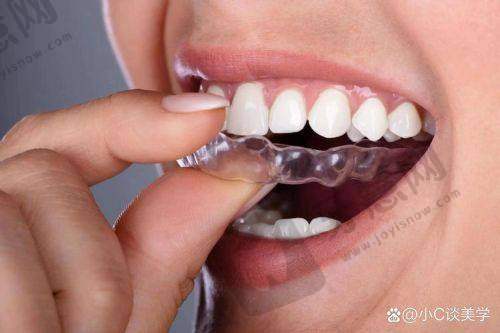 沈阳维尔口腔医院电话号码预约攻略:3种方式任你选