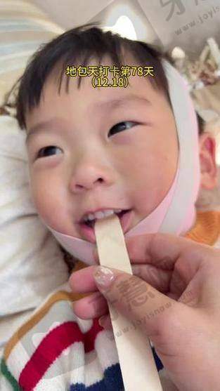 沈阳国信口腔医生简介之患者口碑:98%满意度,这些细节太圈粉!