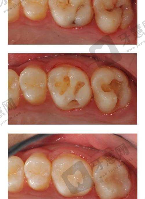 沈阳米兰口腔看牙贵吗之真实患者口碑:看看大家怎么说