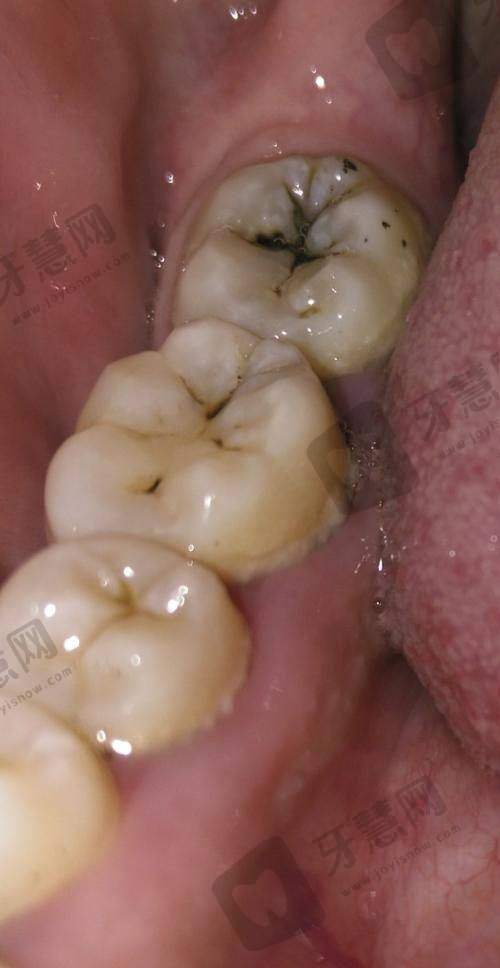 五、沈阳维尔口腔医院的地址周边停车指南:自驾族看这里,300+免费车位