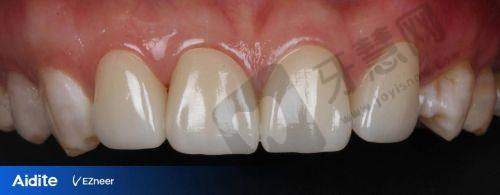 沈阳全好口腔还有几家?铁西区2家门店:聚焦种植牙与美学修复