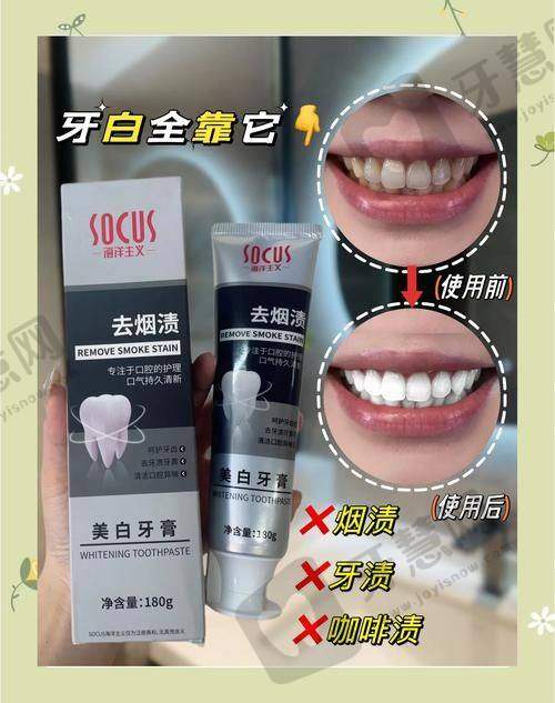 北京牙齿喷砂哪家口腔医院好——北京中诺口腔