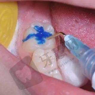 避坑指南：在欢乐口腔看牙前，这5件事一定要知道！
