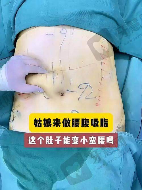 沈阳曙光整形医院是正规医院吗?地址交通与预约攻略