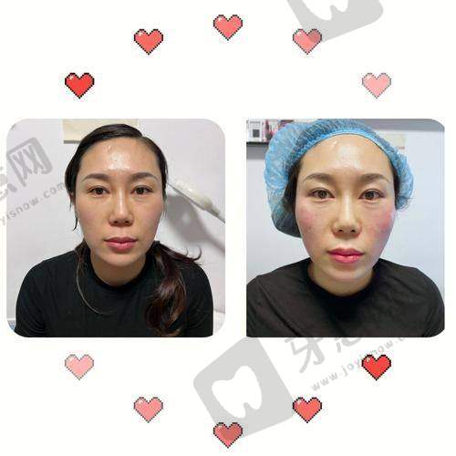 沈阳百嘉丽整形医院是正规医院吗?避坑指南:3步选医生+术前必看注意事项