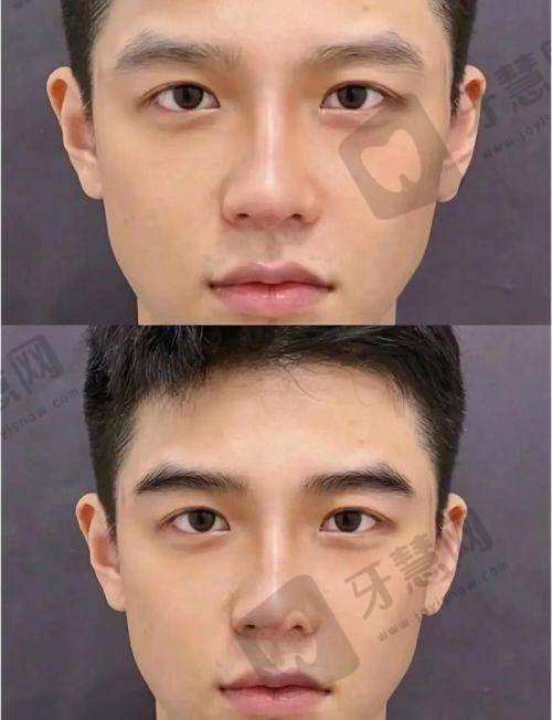 沈阳百嘉丽整形医院是正规医院吗?医生团队:三等甲背景+20年经验,眼鼻胸修复有专攻