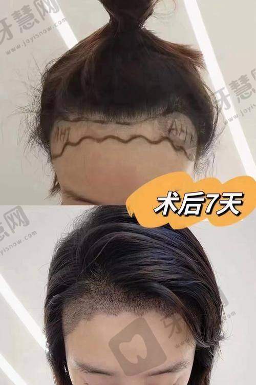 沈阳创美荟整形医院是直客医院吗?适合人群:这些姐妹选它准没错