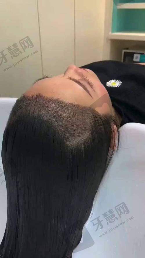 沈阳创美荟整形医院是直客医院吗?2025是!资质正规|医生优|地址电话速查