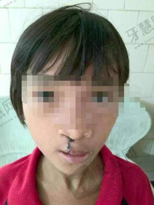 沈阳创美荟整形医院是直客医院吗?资质正规性:直客医院的“硬核门槛”