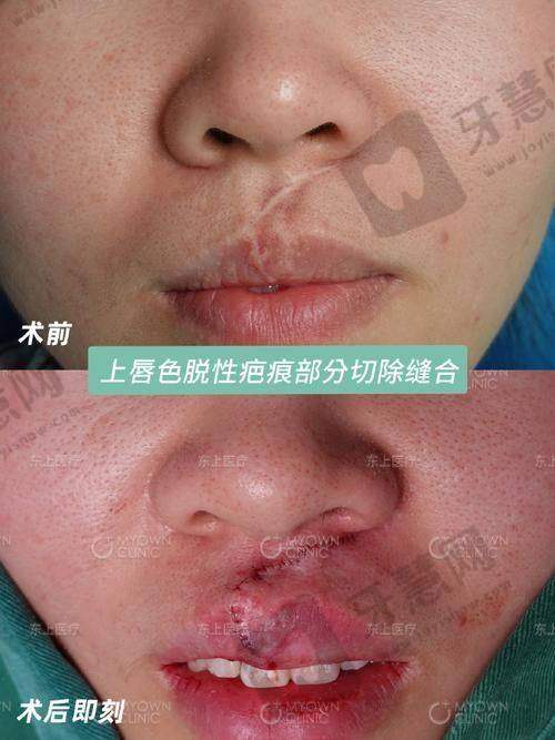沈阳华美疤痕修复中 心正规吗?用户评价和口碑是否真实——大众点评+卫健委平台,好评率98%