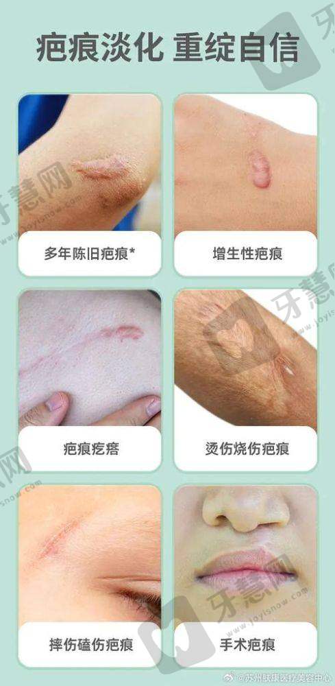 辽宁曙光整形外科医院正规吗?真实成效怎么样?看看做过的姐妹怎么说