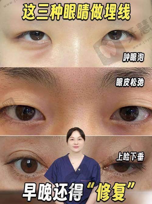 沈阳杏林美容整形医院怎么样:技术硬实力说话,高难度手术+特色项目双在线