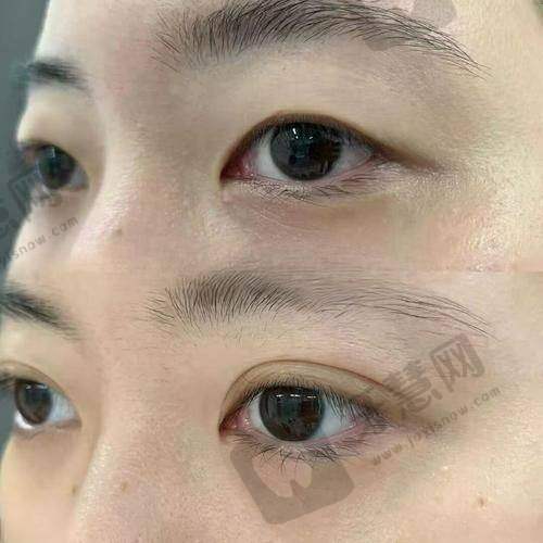 辽宁曙光整形医院电话号码挂号3步通:从电话预约到面诊全流程拆解