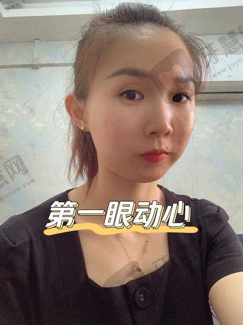 理性提醒:医美没有“速成班”,选择比努力更重要!