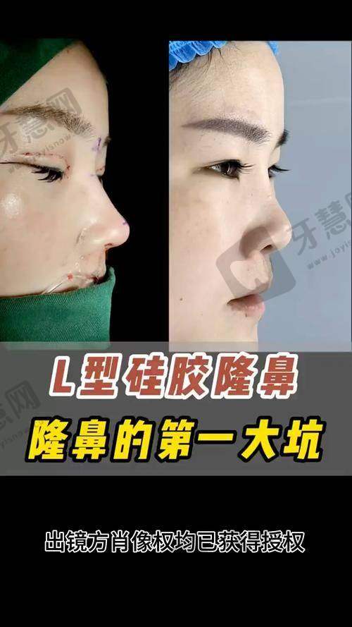 沈阳名流整形医院医生简介:其他特色项目医生推荐,总有一款适合你