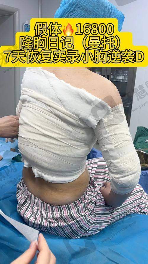 辽宁曙光整形外科医院怎么样啊?拿手项目大盘点——隆胸/吸脂/眼综合,技术特色超安心!