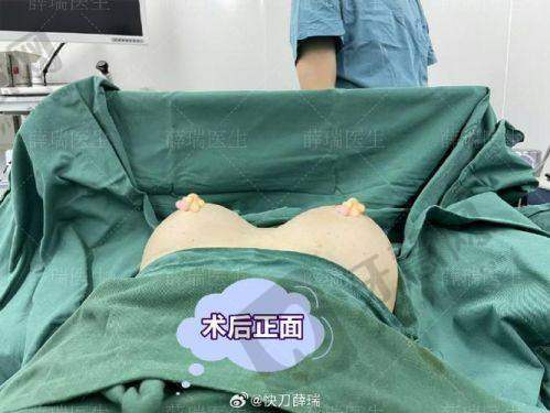 五、辽宁曙光整形医院适合人群:哪些姐妹来这里做医美更合适?