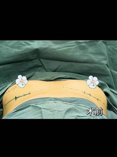 沈阳曙光整形医院电话号码询问时,这些“项目真相”要问清楚!