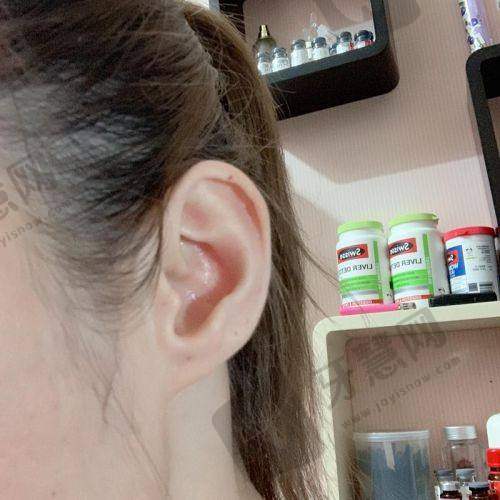 沈阳百嘉丽好还是杏林好?2025资质正规PK|医生技术强+口碑测评(双眼皮/吸脂价格表)