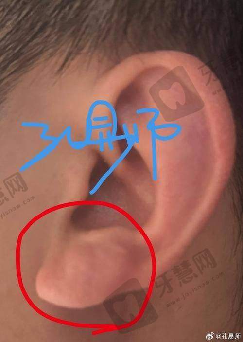 沈阳杏林整形医院好不好?热门项目成效真实吗?