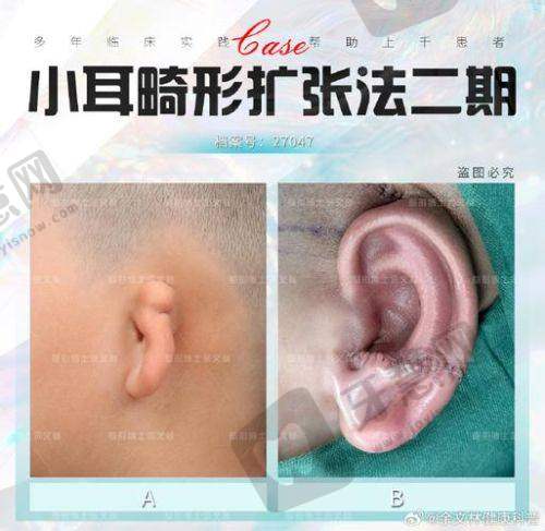 总结:沈阳杏林整形医院好不好?值得选吗?