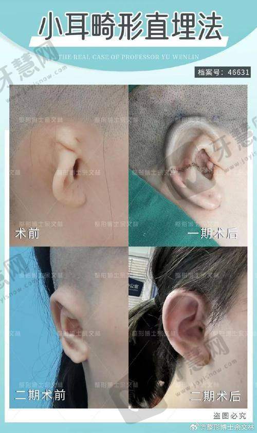 辽宁曙光整形外科医院正规吗?术前术后避坑指南,这些事千万别做!