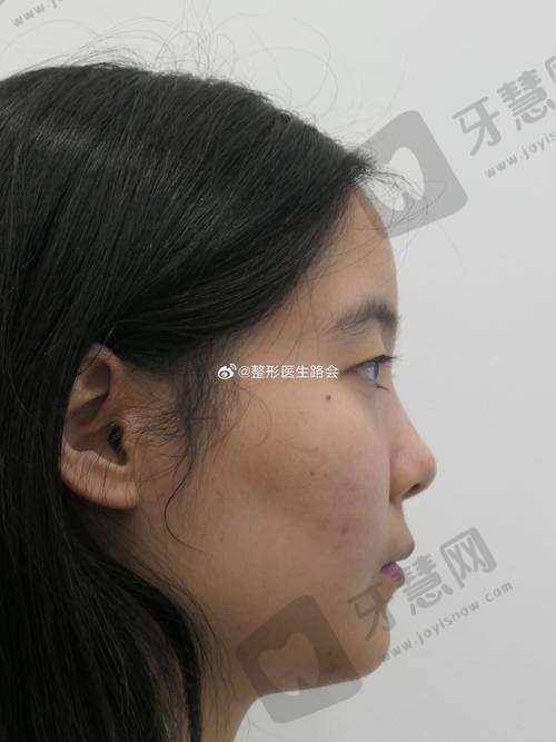 四、辽宁曙光整形医院收费价格透明吗?隆鼻/祛眼袋/隆胸费用参考