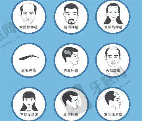 北京禾美嘉BHT植发24000元起顾客实例