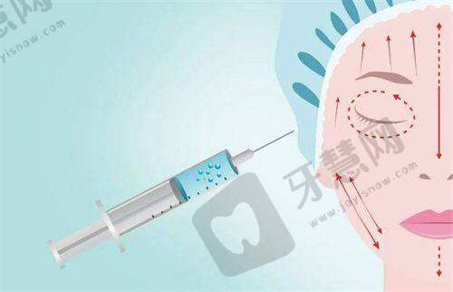 四、男性乳房肥大怎么治疗:2025全新微创方案详解——吸脂+腺体切除联合技术