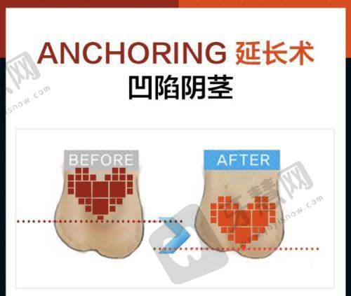 七、男性乳房肥大挂什么科室——就医前必做的5项准备工作