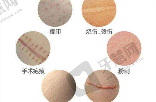 真实实例见证范荣杰隆鼻实力