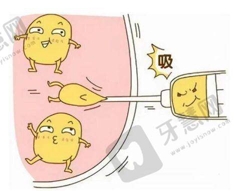三、男性乳房肥大药物治疗的4项关键注意事项