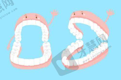 臺灣Abc牙醫集團的牙齒修復服務