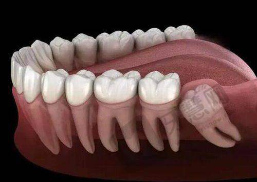 臺灣口腔最出名三個地方是哪些?我安利常春藤、微顏、米蘭診所,體驗超棒!