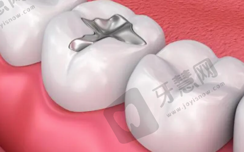 无锡口腔更出名三个地方——无锡金铂利口腔