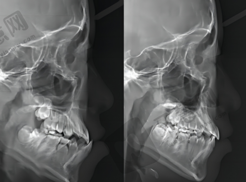 牙得安口腔護理品牌的發展歷程與理念